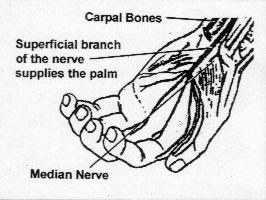 image of carpal bones